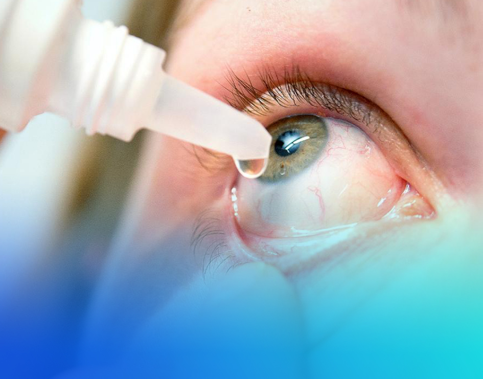 conjuntivitis
