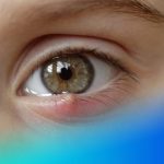 unidad oftalmologica salud visual