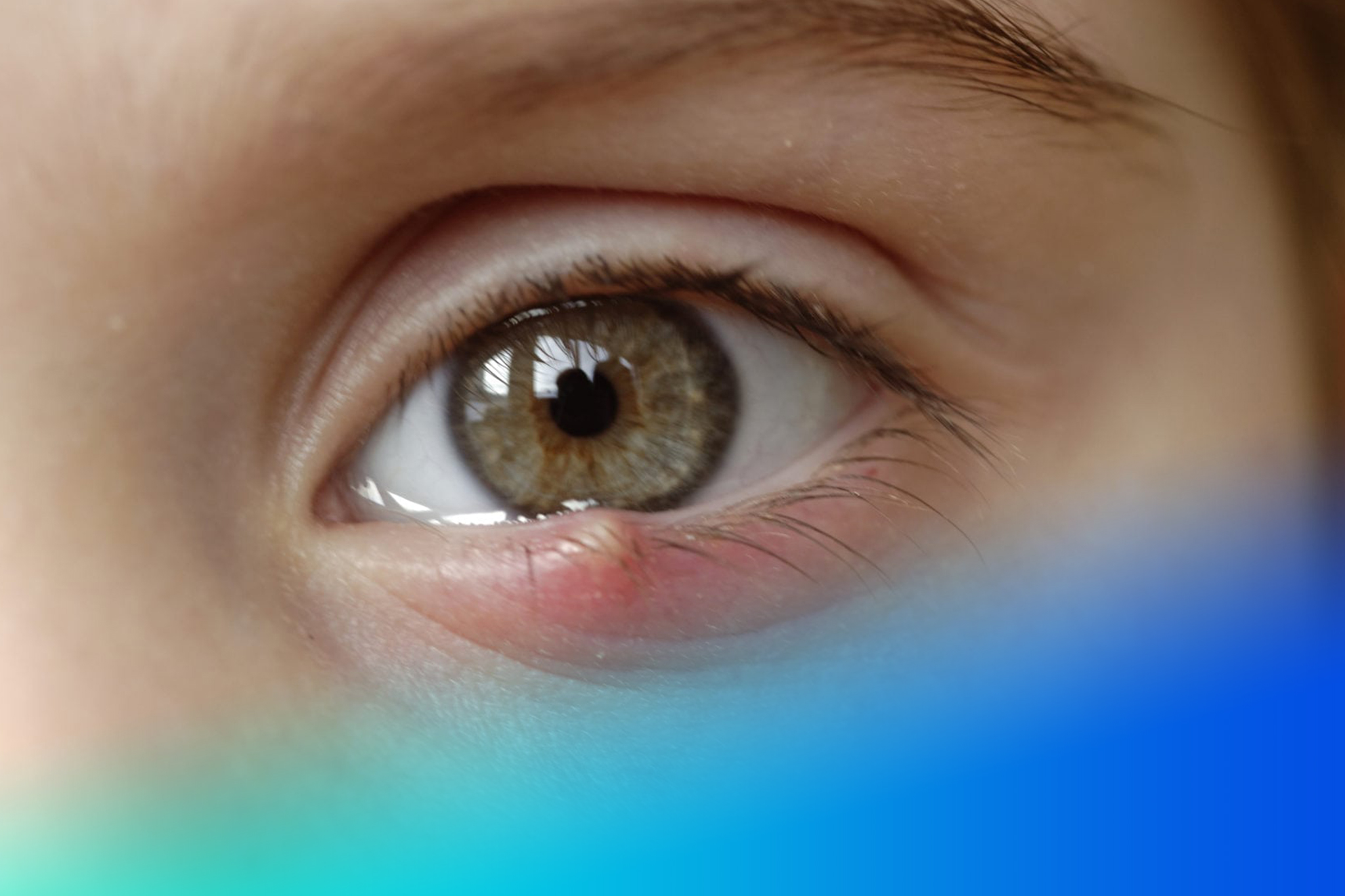 unidad oftalmologica salud visual