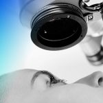 iridotomia láser para glaucoma