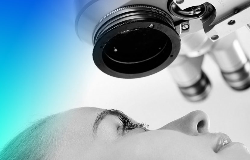 iridotomia láser para glaucoma
