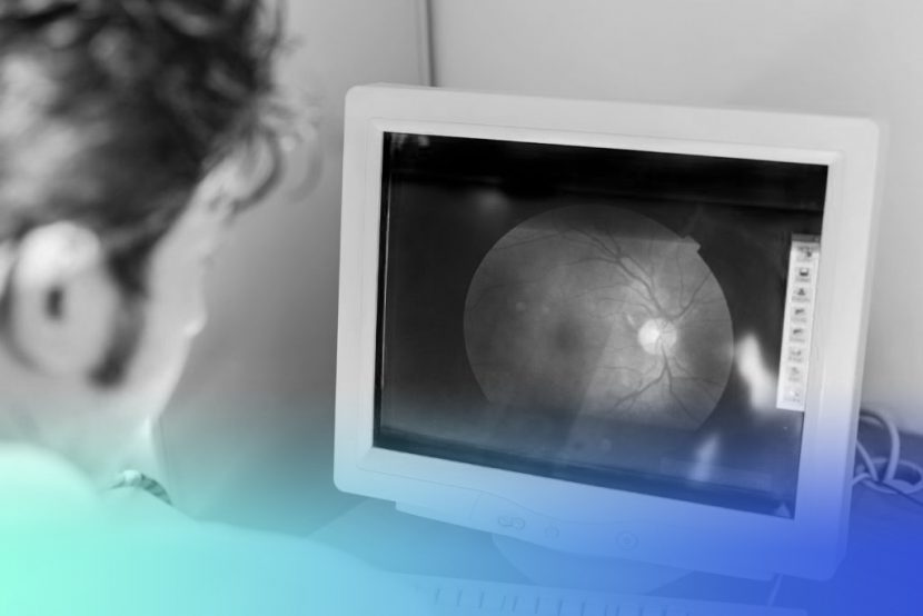 desprendimiento de retina